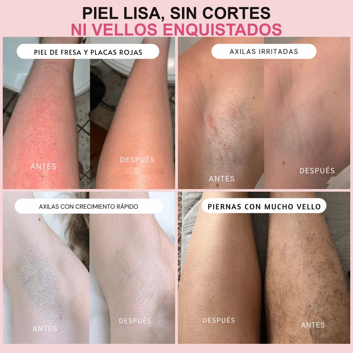 Cuatro antes y después: piel lisa, sin cortes ni vellos enquistados