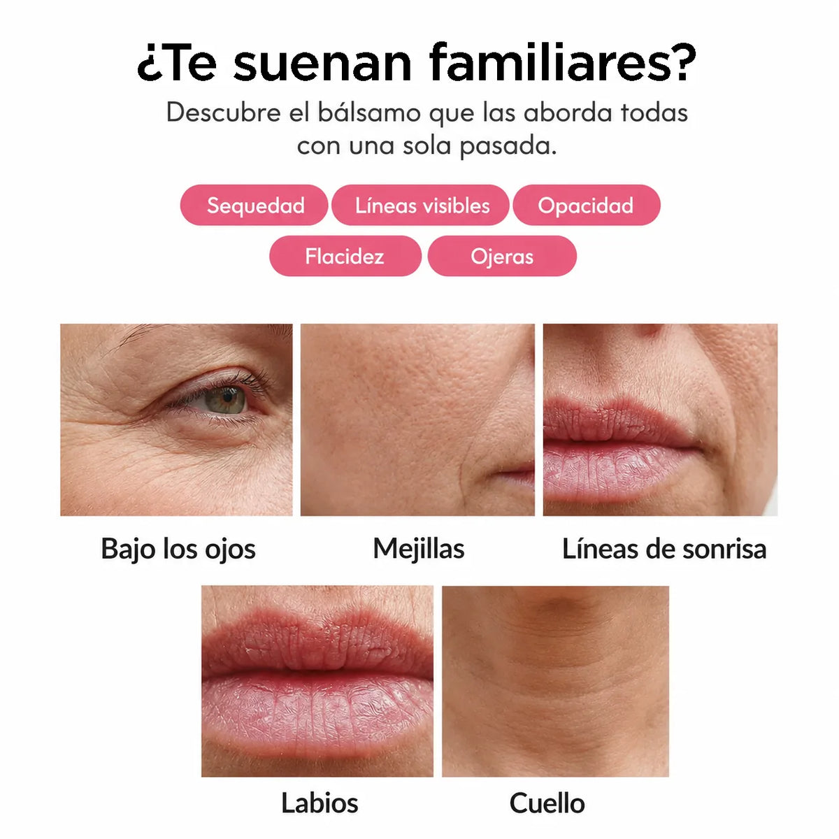 Sequedad, líneas, opacidad, flacidez y ojeras: las cinco zonas de aplicación