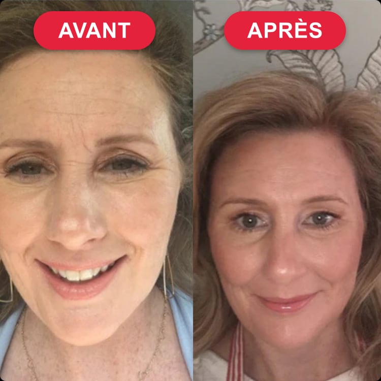 Christine R. — avant / après