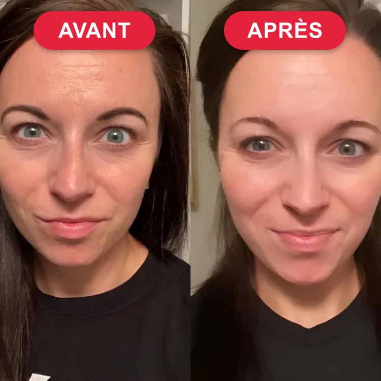 Sarah M. — avant / après