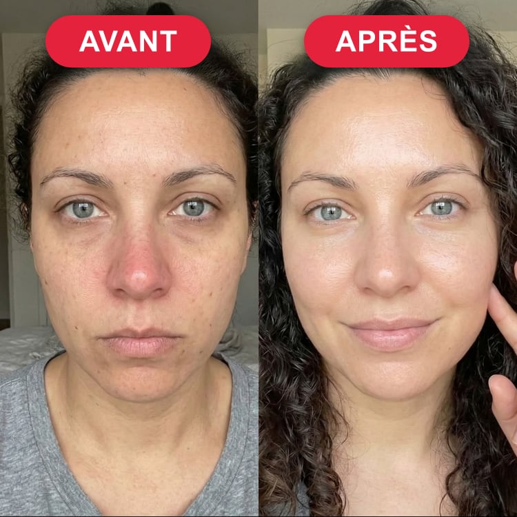 Nathalie B. — avant / après